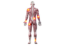 Musculoskeletal Injuries