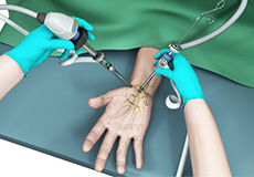 Wrist Arthroscopy